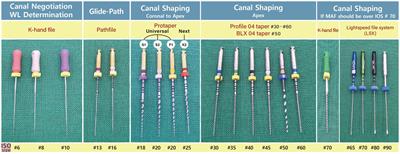 Outcomes of root canal treatments with three different sealers for 120 fractured maxillary fourth premolar teeth in small-to medium-sized dogs